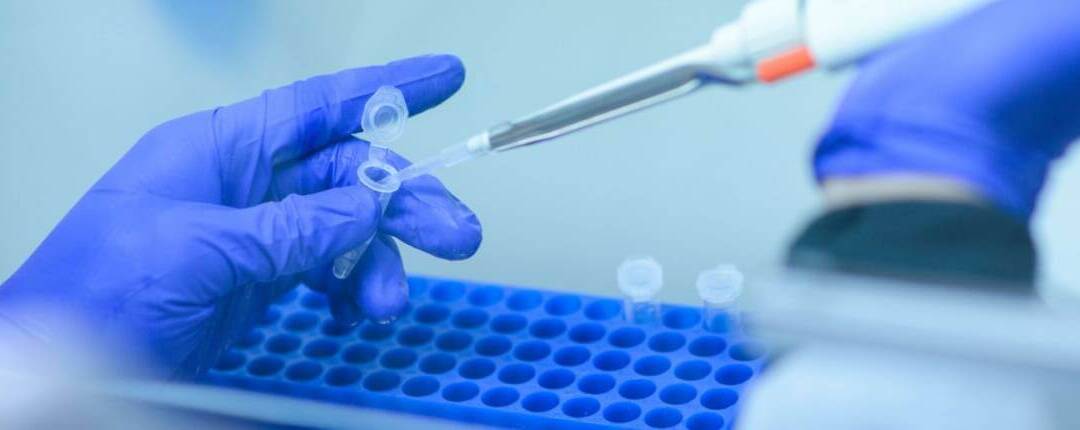 Analysts Required for Large-Scale COVID-19 Testing
